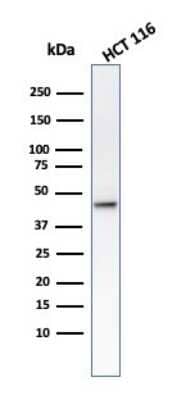 Western Blot: Cytokeratin 8 Antibody (B22.1) - Azide and BSA Free [NBP3-11566] - Western Blot analysis of HCT116 cell lysate using Cytokeratin 8 Antibody (B22.1).