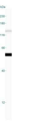 Simple Western: Cytokeratin 8 Antibody (H1) - Azide and BSA Free [NBP2-34626] - Simple Western lane view shows a specific band for Cytokeratin 8 in 0.2 mg/ml of MCF-7 lysate(s). This experiment was performed under reducing conditions using the 12-230 kDa separation system.