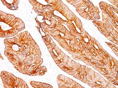 Immunohistochemistry-Paraffin: Cytokeratin 8 Antibody (K8/383) - Azide and BSA Free [NBP2-34656] - Formalin-fixed, paraffin-embedded human colon stained with Cytokeratin 8 MAb (K8/383).