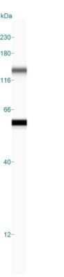 Simple Western: Cytokeratin 8 Antibody (K8/383) - Azide and BSA Free [NBP2-34656] - Simple Western lane view shows a specific band for Cytokeratin 8 in 0.2 mg/ml of MCF-7 lysate(s). This experiment was performed under reducing conditions using the 12-230 kDa separation system.