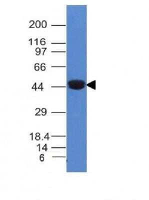 Western Blot: Cytokeratin 8 Antibody (K8/383) - Azide and BSA Free [NBP2-34656] - Western Blot Analysis of A431 cell Lysate using Cytokeratin 8 Monoclonal Antibody (K8/383).