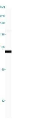 Simple Western: Cytokeratin 8 Antibody (KRT8/899) [NBP2-44941] - Simple Western lane view shows a specific band for Cytokeratin 8 in 0.2 mg/mL of MCF-7 lysate(s). This experiment was performed under reducing conditions using the 12-230 kDa separation system.