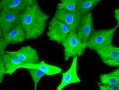 Immunocytochemistry/Immunofluorescence: Cytokeratin 8 Antibody (OTI1B12) - Azide and BSA Free [NBP2-71082] - Staining of A549 cells using anti-Cytokeratin 8 mouse monoclonal antibody.