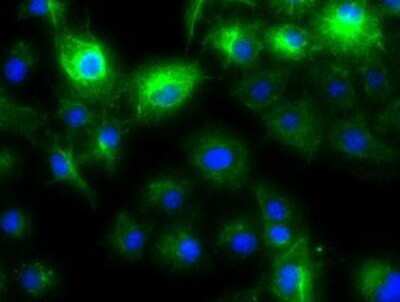 Immunocytochemistry/Immunofluorescence: Cytokeratin 8 Antibody (OTI1B12) - Azide and BSA Free [NBP2-71082] - Staining of COS7 cells transiently transfected by pCMV6-ENTRY Cytokeratin 8.