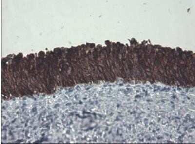 Immunohistochemistry: Cytokeratin 8 Antibody (OTI1B12) - Azide and BSA Free [NBP2-71082] - Staining of paraffin-embedded Human bladder tissue within the normal limits using anti-KRT8 mouse monoclonal antibody at 1:150 dilution.