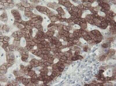 Immunohistochemistry: Cytokeratin 8 Antibody (OTI1B12) - Azide and BSA Free [NBP2-71082] - Staining of paraffin-embedded Human liver tissue within the normal limits using anti-KRT8 mouse monoclonal antibody at 1:150 dilution.