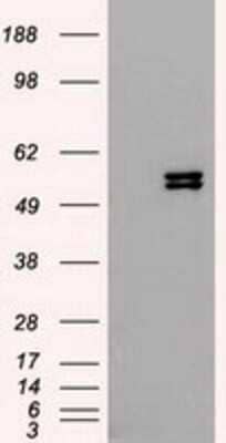 Western Blot: Cytokeratin 8 Antibody (OTI1B12) - Azide and BSA Free [NBP2-71082] - HEK293T cells were transfected with the pCMV6-ENTRY control (Left lane) or pCMV6-ENTRY Cytokeratin 8 (Right lane) cDNA for 48 hrs and lysed. Equivalent amounts of cell lysates (5 ug per lane) were separated by SDS-PAGE and immunoblotted with anti-Cytokera