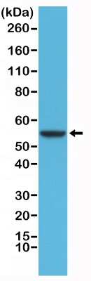 Western Blot: Cytokeratin 8 Antibody (RM266) [NBP2-61526] - Western Blot of HeLa cells lysates using NBP2-61526.
