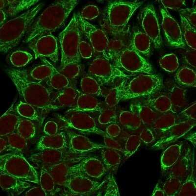 Immunocytochemistry/Immunofluorescence: Cytokeratin 8 Antibody (SPM192) - Azide and BSA Free [NBP2-34400] - Immunofluorescence Analysis of HeLa cells labeling CK8 with Cytokeratin 8 Antibody (SPM192) followed by Goat anti-Mouse IgG-CF488 (Green). The nuclear counterstain is Red Dot (Red).