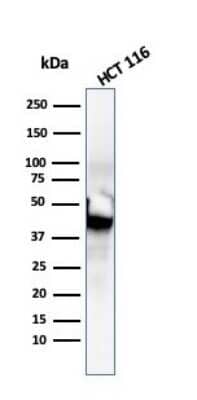Western Blot: Cytokeratin 8 Antibody (SPM192) - Azide and BSA Free [NBP2-34400] - Western Blot Analysis of HCT116 cell lysate using Cytokeratin 8 MAb (SPM192).