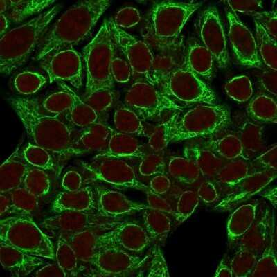 Immunocytochemistry/Immunofluorescence: Cytokeratin 8 Antibody (SPM192) [NBP2-34352] - Immunofluorescence Analysis of HeLa cells labeling CK8 with Cytokeratin 8 Antibody (SPM192) followed by Goat anti-Mouse IgG-CF488 (Green). The nuclear counterstain is Red Dot (Red).