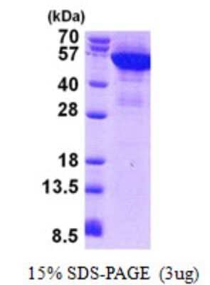 SDS-PAGE Recombinant Human Cytokeratin 8 His Protein