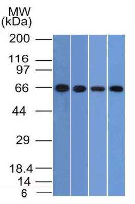 Western Blot: Cytokeratin, Acidic (Type I or LMW) Antibody (KRTL/1577) [NBP2-50072] - Jurkat, A431, PC3 and A375 Cell Lysate using Cytokeratin, LMW Monoclonal Antibody (KRTL/1477).