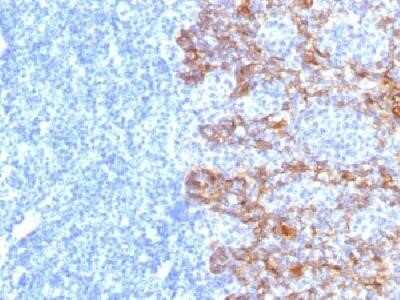 Immunohistochemistry-Paraffin: Cytokeratin, Acidic (Type I or LMW) Antibody (SPM115) - Azide and BSA Free [NBP2-34393] - Formalin-fixed paraffin-embedded human tonsil stained with cytokeratin, LMW Monoclonal antibody (SPM115)