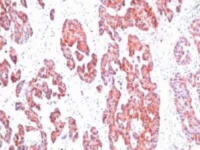 Immunohistochemistry-Paraffin Cytokeratin, Basic (Type II or HMW) Antibody (SPM116) - IHC-Prediluted