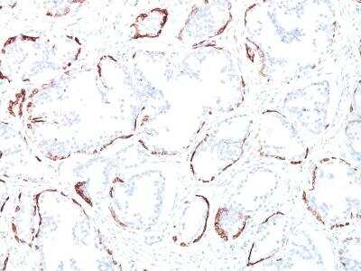 Immunohistochemistry-Paraffin: Cytokeratin, HMW Antibody (34BE12) [NBP2-34340] - Formalin-fixed, paraffin-embedded human prostate (10X) stained with Cytokeratin, HMW MAb (34bE12).