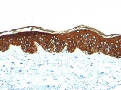 Immunohistochemistry-Paraffin: Cytokeratin, HMW Antibody (AE-3) - IHC-Prediluted [NBP2-48233] - Formalin-fixed, paraffin-embedded human skin stained with Cytokeratin, HMW Mouse Monoclonal Antibody (AE-3).