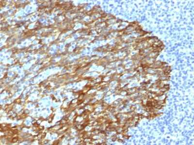 Immunohistochemistry-Paraffin: Cytokeratin, HMW Antibody (DE-SQ) - Azide and BSA Free [NBP3-08718] - Formalin-fixed, paraffin-embedded human Tonsil stained with Cytokeratin, HMW Mouse Monoclonal Antibody (DE-SQ).