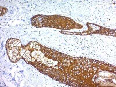 Immunohistochemistry-Paraffin: Cytokeratin, HMW Antibody (KRTH/1076) - Azide and BSA Free [NBP2-47690] - Human Skin stained with Cytokeratin, HMW Monoclonal Antibody (KRTH/1076).