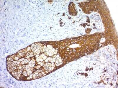 Immunohistochemistry-Paraffin: Cytokeratin, HMW Antibody (KRTH/1576R) - Azide and BSA Free [NBP2-54589] - Formalin-fixed, paraffin-embedded human Skin stained with Cytokeratin, HMW Recombinant Rabbit Monoclonal Antibody (KRTH/1576R).