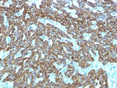 Immunohistochemistry-Paraffin: Cytokeratin, HMW Antibody (KRTH/1576R) - Azide and BSA Free [NBP2-54589] - Formalin-fixed, paraffin-embedded human Skin stained with Cytokeratin, HMW Antibody (KRTH/1576R).