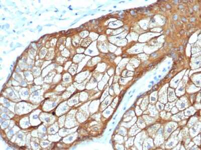 Immunohistochemistry-Paraffin: Cytokeratin, HMW Antibody (rKRTH/6617) - Azide and BSA Free [NBP3-08675] - Formalin-fixed, paraffin-embedded human sebaceous gland stained with Cytokeratin, HMW Recombinant Mouse Monoclonal Antibody (rKRTH/6617).