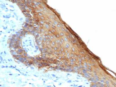 Immunohistochemistry-Paraffin: Cytokeratin, HMW Antibody (rKRTH/6617) - Azide and BSA Free [NBP3-08675] - Formalin-fixed, paraffin-embedded human skin stained with Cytokeratin, HMW Recombinant Mouse Monoclonal Antibody (rKRTH/6617).