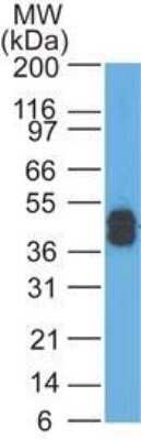 Western Blot: Cytokeratin, LMW Antibody (AE-1) - Azide and BSA Free [NBP2-33178] - Analysis of A431 lysate using Cytokeratin antibody at 0.25 ug/ml.