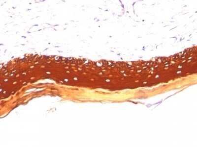 Immunohistochemistry-Paraffin: Cytokeratin, LMW Antibody (KRTL/1077) - Azide and BSA Free [NBP2-47798] - Human Skin stained with Cytokeratin, LMW Monoclonal Antibody (KRTL/1077).
