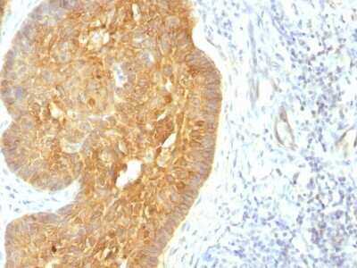 Immunohistochemistry-Paraffin: Cytokeratin, LMW Antibody (KRTL/1377) [NBP2-53377] - Formalin-fixed, paraffin-embedded human Skin stained with Cytokeratin, LMW Monoclonal Antibody (KRTL/1377).