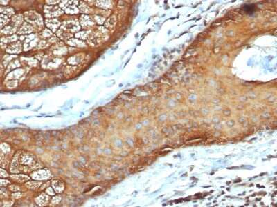 Immunohistochemistry-Paraffin: Cytokeratin, LMW Antibody (rKRTL/6616) - Azide and BSA Free [NBP3-08674] - Formalin-fixed, paraffin-embedded human skin stained with Cytokeratin, LMW Recombinant Mouse Monoclonal Antibody (rKRTL/6616).