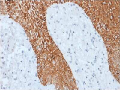 Immunohistochemistry-Paraffin: Cytokeratin, pan Antibody (KRT/1877R) - Azide and BSA Free [NBP3-08398] - Formalin-fixed, paraffin-embedded human Skin stained with Cytokeratin, pan Recombinant Rabbit Monoclonal Antibody (KRT/1877R).