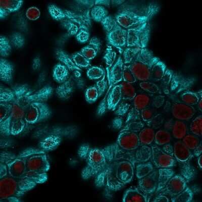 Immunocytochemistry/Immunofluorescence: Cytokeratin, pan Antibody (PAN-CK (Cocktail)) - Azide and BSA Free [NBP2-76425] - Confocal immunofluorescent analysis of HeLa cells using Cytokeratin, panMouse Monoclonal Antibody (PAN-CK) followed by goat anti-mouse IgG-CF488 (cyan). Nuclei are counterstained with NucSpot (red).