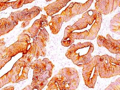 Immunohistochemistry-Paraffin: Cytokeratin, pan Antibody (SPM583) - IHC-Prediluted [NBP2-48197] - FFPE colon tissue (10X) stained with Multi Keratin Monoclonal Antibody (SPM583).