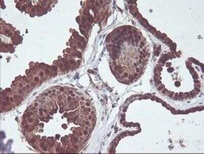 Immunohistochemistry: Cytosol Nonspecific Dipeptidase (CNDP2)/CPGL Antibody (OTI8A2) - Azide and BSA Free [NBP2-72019] - Staining of paraffin-embedded Human breast tissue using anti-CNDP2 mouse monoclonal antibody.