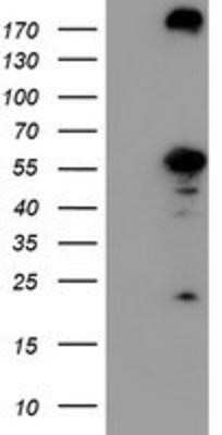 Western Blot: Cytosol Nonspecific Dipeptidase (CNDP2)/CPGL Antibody (OTI8A2) - Azide and BSA Free [NBP2-72019] - HEK293T cells were transfected with the pCMV6-ENTRY control (Left lane) or pCMV6-ENTRY CNDP2 (Right lane) cDNA for 48 hrs and lysed. Equivalent amounts of cell lysates (5 ug per lane) were separated by SDS-PAGE and immunoblotted with anti-CNDP2.