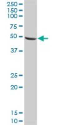 Western Blot: Cytosol Nonspecific Dipeptidase (CNDP2)/CPGL Antibody [H00055748-D01P] - Analysis of CNDP2 expression in human kidney.