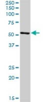 Western Blot: Cytosol Nonspecific Dipeptidase (CNDP2)/CPGL Antibody [H00055748-D01P] - Analysis of CNDP2 expression in mouse kidney.