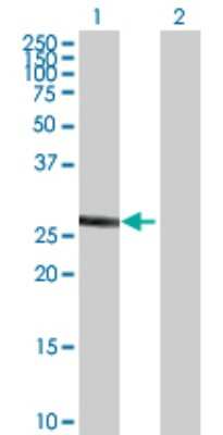 Western Blot: Cytosolic Sulfotransferase 1A1/SULT1A1 Antibody [H00006817-B01P] - Analysis of SULT1A1 expression in transfected 293T cell line by SULT1A1 polyclonal antibody.  Lane 1: SULT1A1 transfected lysate(32.45 KDa). Lane 2: Non-transfected lysate.