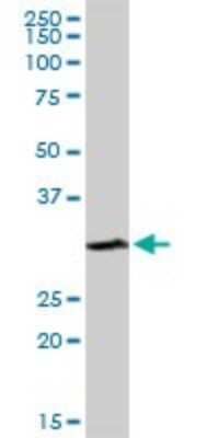 Western Blot: Cytosolic Sulfotransferase 1A1/SULT1A1 Antibody [H00006817-D01P] - Analysis of SULT1A1 expression in human liver.