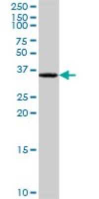 Western Blot: Cytosolic Sulfotransferase 1A1/SULT1A1 Antibody [H00006817-D01P] - Analysis of SULT1A1 expression in mouse liver.