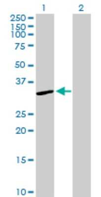 Western Blot: Cytosolic Sulfotransferase 1A1/SULT1A1 Antibody [H00006817-D01P] - Analysis of SULT1A1 expression in transfected 293T cell line by SULT1A1 polyclonal antibody.Lane 1: SULT1A1 transfected lysate(34.10 KDa).Lane 2: Non-transfected lysate.