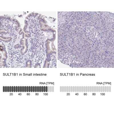 <b>Orthogonal Strategies Validation. </b>Immunohistochemistry-Paraffin: Cytosolic Sulfotransferase 1B1/SULT1B1 Antibody [NBP1-86995] - Analysis in human small intestine and pancreas tissues. Corresponding SULT1B1 RNA-seq data are presented for the same tissues.