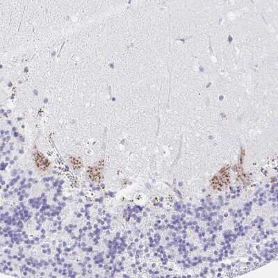 Immunohistochemistry-Paraffin: Cytosolic Sulfotransferase 1B1/SULT1B1 Antibody [NBP1-86995] - Staining of human cerebellum shows moderate positivity in cytoplasm granular in Purkinje cells.