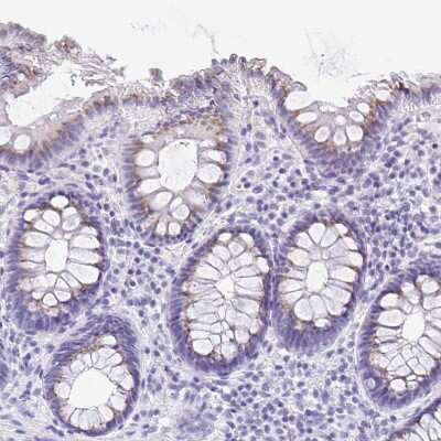 Immunohistochemistry-Paraffin: Cytosolic Sulfotransferase 1B1/SULT1B1 Antibody [NBP1-86995] - Staining of human colon shows weak granular positivity in cytoplasm in glandular cells.