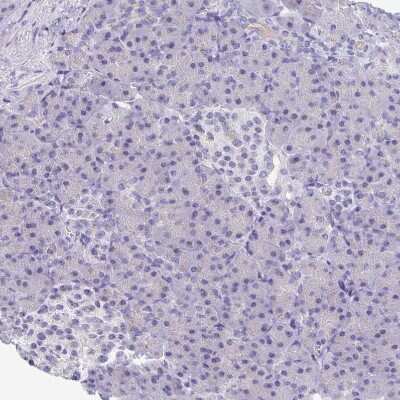 Immunohistochemistry-Paraffin: Cytosolic Sulfotransferase 1B1/SULT1B1 Antibody [NBP1-86995] - Staining of human pancreas shows no positivity in exocrine glandular cells as expected.