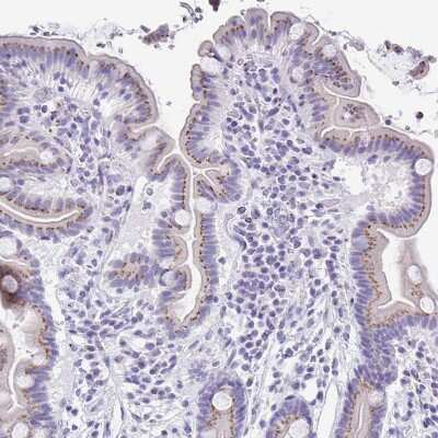 Immunohistochemistry-Paraffin: Cytosolic Sulfotransferase 1B1/SULT1B1 Antibody [NBP1-86995] - Staining of human small intestine shows moderate granular positivity in cytoplasm in glandular cells.