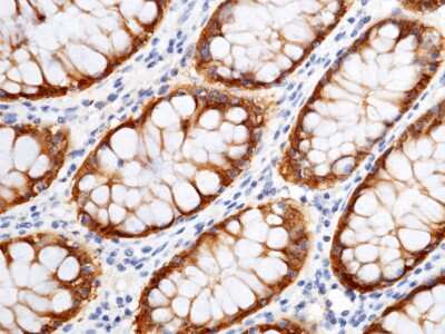 Immunohistochemistry-Paraffin: Cytosolic Sulfotransferase 1B1/SULT1B1 Antibody [NBP2-99836] - Immunochemical staining of human Cytosolic Sulfotransferase 1B1/SULT1B1 in human spleen with rabbit polyclonal antibody (1:1000, formalin-fixed paraffin embedded sections). The left panel: tissue incubated with primary antibody; The right panel: tissue in