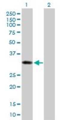 Western Blot: Cytosolic Sulfotransferase 1B1/SULT1B1 Antibody [H00027284-B02P] - analysis of SULT1B1 expression in transfected 293T cell line by SULT1B1 MaxPab polyclonal antibody. Lane 1: SULT1B1 transfected lysate (32.56 KDa). Lane 2: Non-transfected lysate.