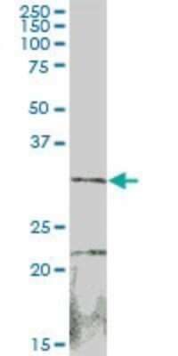 Western Blot: Cytosolic Sulfotransferase 1B1/SULT1B1 Antibody [H00027284-B02P] - Analysis of SULT1B1 expression in human kidney.